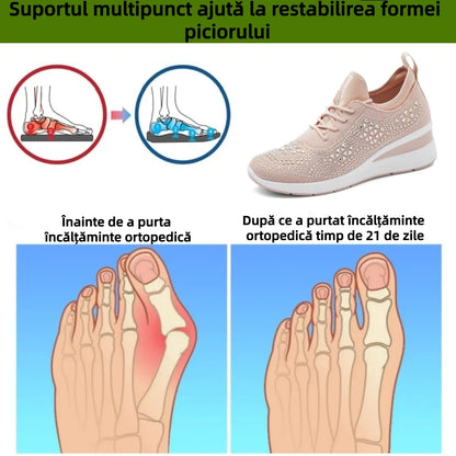 【⏰Oferta specială de astăzi: 70% reducere - Nu ratați!】 Încălțăminte ergonomică pentru toate anotimpurile – ✅️ Rezolvă cu ușurință problemele legate de durerile de picioare
