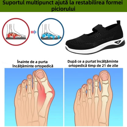 【🎁Ultima zi pentru o reducere de 70%, nu ratați!】Încălțăminte ortopedică ergonomică cu suport pentru arcul plantar✅️, care face mersul fără durere👞