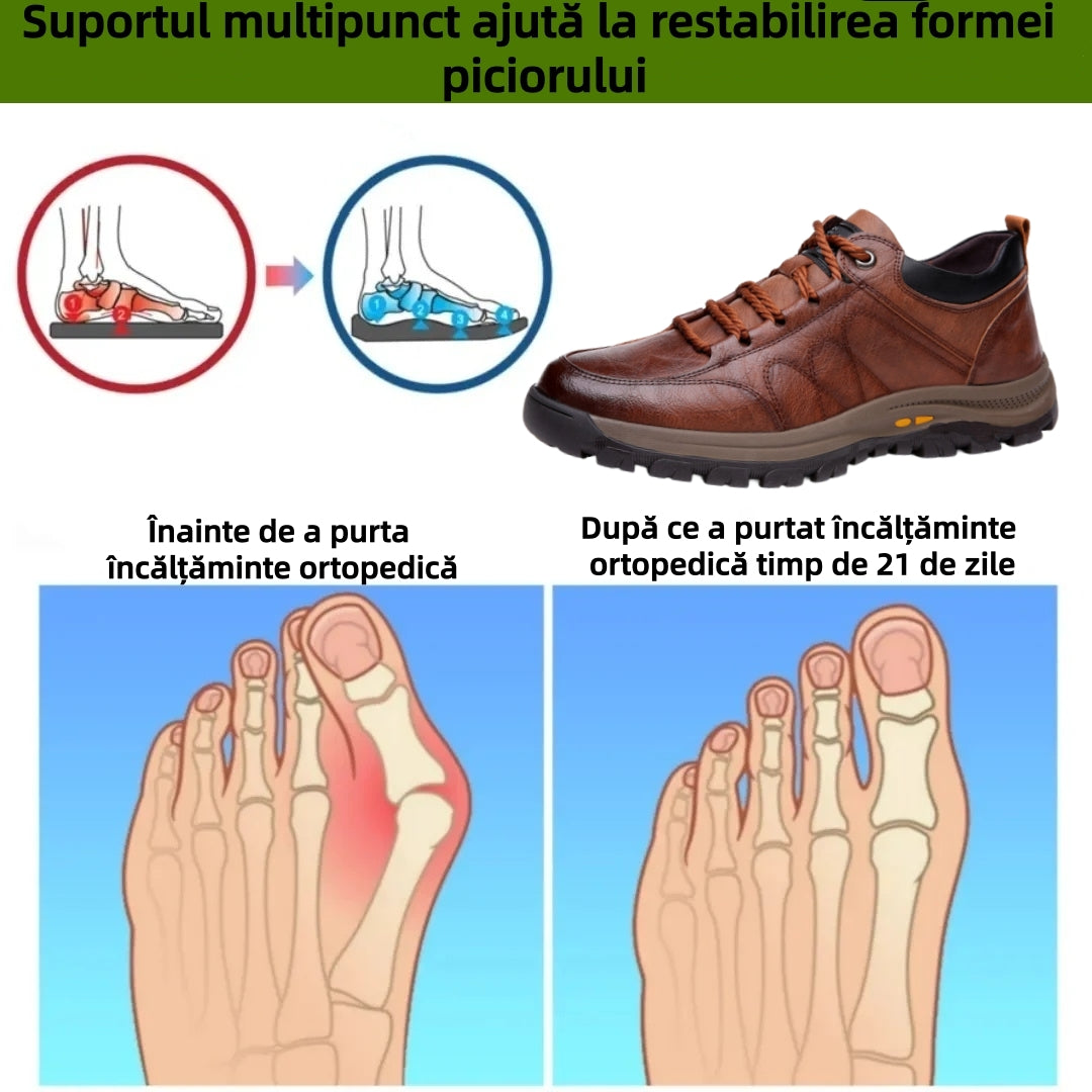 【🎁Ofertă limitată în timp: Reducere 70%】Pantofi ortopedici australieni autentici, confortabili, fabricați din piele de vițel selectată👞 (Suport pentru arcadă - ameliorează durerea piciorului), îmbunătățind confortul la mers✅