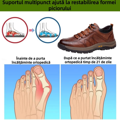 【🎁Ofertă limitată în timp: Reducere 70%】Pantofi ortopedici australieni autentici, confortabili, fabricați din piele de vițel selectată👞 (Suport pentru arcadă - ameliorează durerea piciorului), îmbunătățind confortul la mers✅