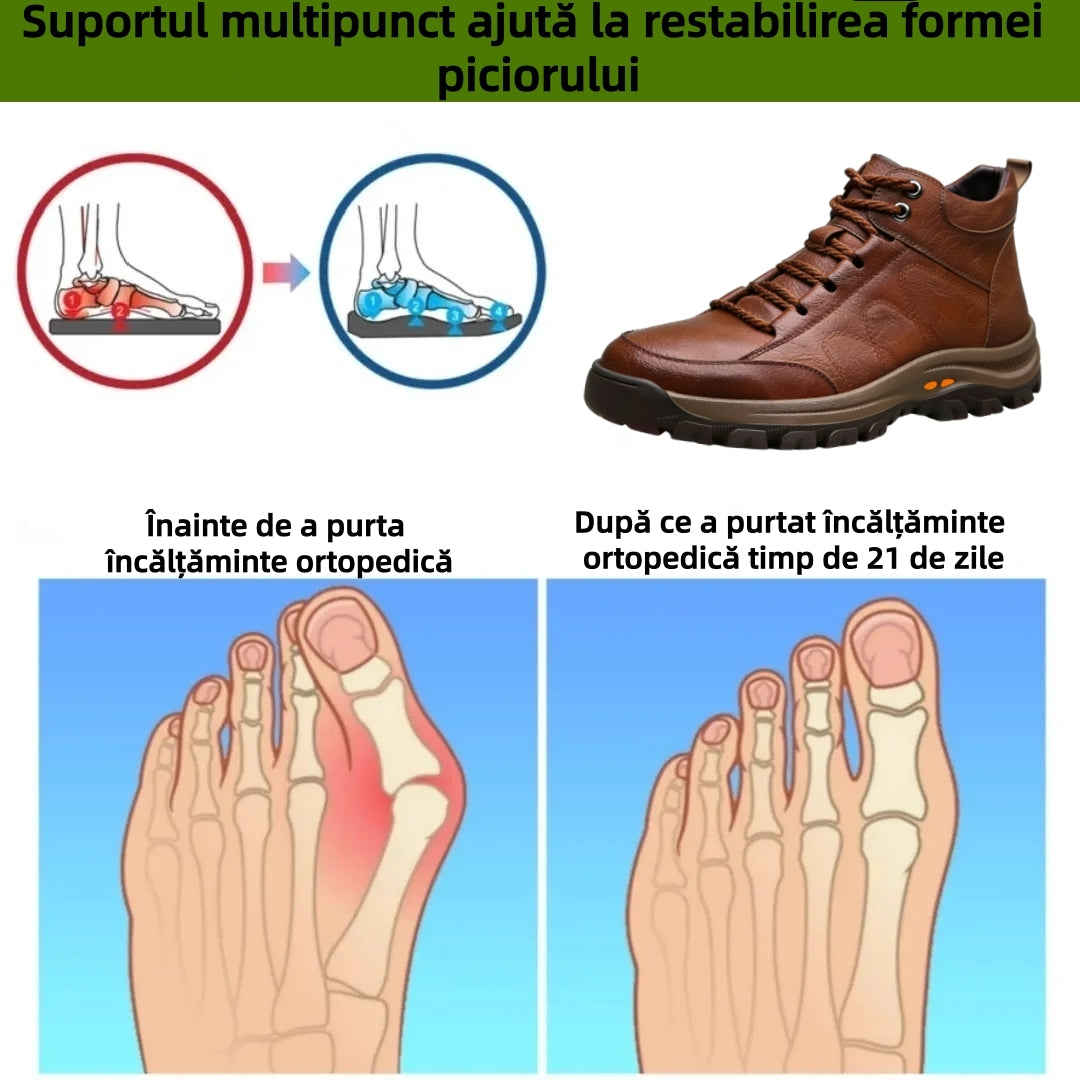 ⏰Ultima zi! Reducere 70%⏰ Pantofi ortopedici australieni autentici, confecționați din piele de vițel 👞 Suport pentru bolta plantară - ameliorează durerile de spate, articulații și picioare. ✅